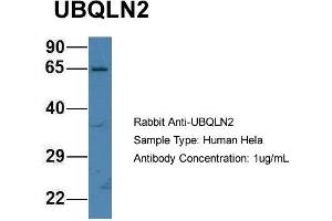 Host: Rabbit Target Name: UBQLN2 Sample Type: Hela Antibody Dilution: 1. (Ubiquilin 2 antibody  (N-Term))