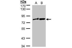 WB Image Sample(30 ug whole cell lysate) A: MOLT4 , B: Raji , 7.