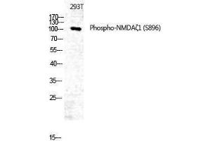 Western Blotting (WB) image for anti-Glutamate Receptor, Ionotropic, N-Methyl D-Aspartate 1 (GRIN1) (pSer896) antibody (ABIN3182580) (GRIN1/NMDAR1 antibody  (pSer896))