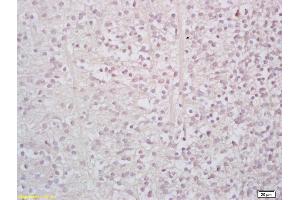 Formalin-fixed and paraffin embedded mouse embryo labeled with Rabbit Anti StAR/StARD1 Polyclonal Antibody, Unconjugated (ABIN700960) at 1:200 followed by conjugation to the secondary antibody and DAB staining (STAR antibody  (AA 101-200))