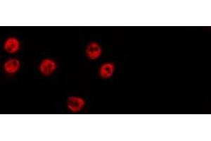 ABIN6274098 staining HepG2 by IF/ICC. (GSC2 antibody  (Internal Region))