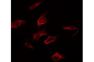 ABIN6267281 staining Hela by IF/ICC. (RAF1 antibody  (pSer259))