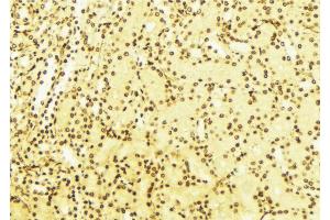 ABIN6268682 at 1/100 staining Mouse liver tissue by IHC-P.