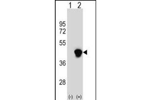 Western blot analysis of PECI (arrow) using rabbit polyclonal PECI Antibody (C-term) (ABIN652636 and ABIN2842426). (PECI/ECI2 antibody  (C-Term))