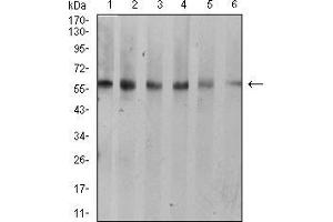 Western blot analysis using KRT10 mouse mAb against A431 (1), C6 (2), COS7 (3), Jurkat (4), NIH/3T3 (5), and HEK293 (6) cell lysate. (Keratin 10 antibody  (AA 345-454))
