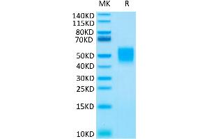 FCAR Protein (His tag)