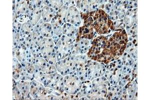 Immunohistochemical staining of paraffin-embedded liver tissue using anti-HSPA1Amouse monoclonal antibody. (HSP70 1A antibody)