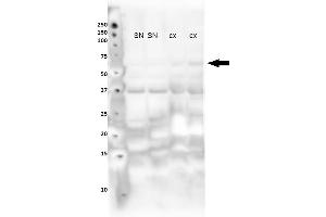 Lanes : Lane 1: Nuclear fraction from mouse substantia nigra Lane 2: Nuclear fraction from mouse substantia nigra Lane 3: Nuclear fraction from mouse cortex Lane 4: Nuclear fraction from mouse cortex Primary Antibody Dilution :  1:400   Secondary Antibody : Goat anti rabbit-HRP  Secondary Antibody Dilution :  1:10,000  Gene Name : NR4A2  Submitted by : Sorce Silvia, University of Zurich (NR4A2 antibody  (N-Term))