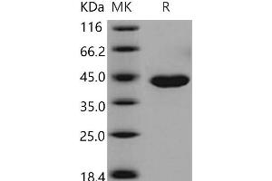 CPA1 Protein (His tag)