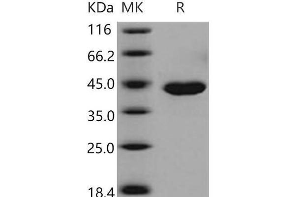 CPA1 Protein (His tag)