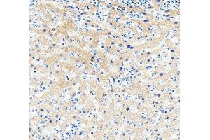 anti-WAP Four-Disulfide Core Domain 2 (WFDC2) (AA 31-124) antibody