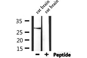 Western blot analysis of extracts from rat brain, using THY1 Antibody. (CD90 antibody  (Internal Region))