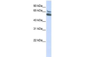 WB Suggested Anti-ALOX15B Antibody Titration:  0. (ALOX15B antibody  (N-Term))