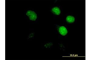 Immunofluorescence of purified MaxPab antibody to CDCA8 on HeLa cell.