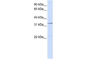 WB Suggested Anti-GTF2E2 Antibody Titration:  0. (GTF2E2 antibody  (Middle Region))
