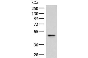 Western blot analysis of Human fetal liver tissue lysate using RMDN2 Polyclonal Antibody at dilution of 1:750 (FAM82A1 antibody)