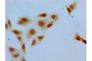 Immunocytochemistry analysis of Hela cells using ABIN7139607 at dilution of 1:100 (H2AFZ antibody  (meLys7))
