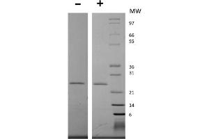 SDS-PAGE of Human Epstein-Barr Virus Induced Gene 3 Recombinant Protein (Animal Free) SDS-PAGE of Human Epstein-Barr Virus Induced Gene 3 Animal Free Recombinant Protein. (EBI3 Protein)