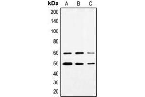 Western blot analysis of SYT expression in HeLa (A), Jurkat (B), A431 (C) whole cell lysates.