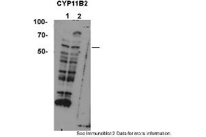 Sample type: 1. (CYP11B2 antibody  (Middle Region))