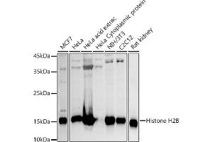 Western blot analysis of extracts of various cell lines, using Histone H2B antibody (ABIN3015764, ABIN3015765, ABIN3015766 and ABIN6219109) at 1:1000 dilution.