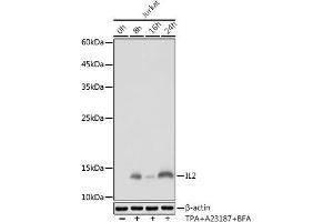 Western blot analysis of extracts of Jurkat cells, using IL2 antibody (ABIN7267993) at 1:1000 dilution. (IL-2 antibody)