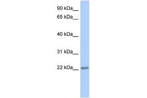 WB Suggested Anti-TRAPPC5 Antibody Titration: 0. (TRAPPC5 antibody  (Middle Region))