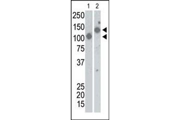 SARS-CoV Spike antibody  (AA 13-42)