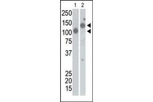 The anti-SARS-Sn Pab (ABIN1882129 and ABIN2840580) is used in Western blot to detect recombinant Spike proteins, aa17-537 (Lane 1) and aa17-756 (Lane 2). (SARS-CoV Spike antibody  (AA 13-42))
