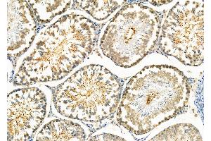 ABIN6260488 and ABIN6273998 at 1/100 staining Rat testis tissue by IHC-P. (Caspase 2 antibody  (Internal Region))