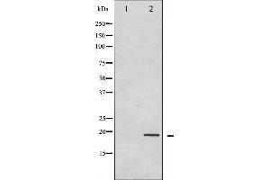 Western blot analysis of Synuclein- alpha phosphorylation expression in Etoposide treated 293 whole cell lysates,The lane on the left is treated with the antigen-specific peptide. (SNCA antibody  (pTyr133))