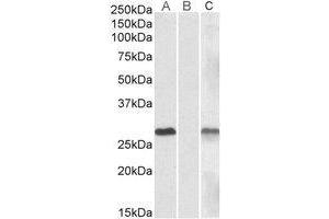 Lane A: AP23775PU-N 1µg/ml) staining of HEK293 overexpressing Human DYDC1 lysate (10µg protein in RIPA buffer).