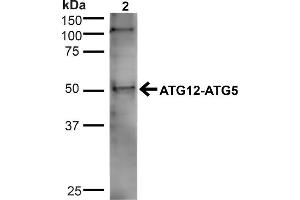 Western blot analysis of Human Cervical cancer cell line (HeLa) lysate showing detection of ~32. (ATG5 antibody  (N-Term) (Alkaline Phosphatase (AP)))