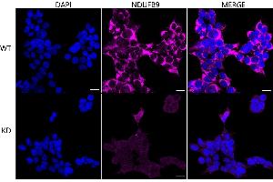 anti-NADH Dehydrogenase (Ubiquinone) 1 beta Subcomplex, 9, 22kDa (NDUFB9) antibody