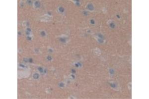 Figure. (SEMA3A antibody  (AA 31-141))