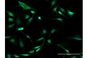 Immunofluorescence of purified MaxPab antibody to GALT on HeLa cell. (GALT antibody  (AA 1-379))