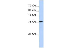 WB Suggested Anti-ATP6V0D2 Antibody Titration: 0. (ATP6V0D2 antibody  (Middle Region))