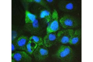 IF analysis of ARA9/AIP using anti-ARA9/AIP antibody (ABIN6719423). (AIP antibody  (AA 91-330))