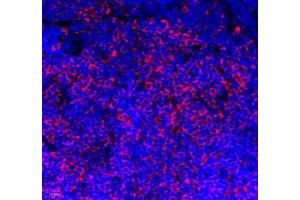 Immunofluorescence of paraffin embedded mouse lymph node using IL-27A (ABIN7074367) at dilution of 1: 800 (400x lens) (IL27 antibody)