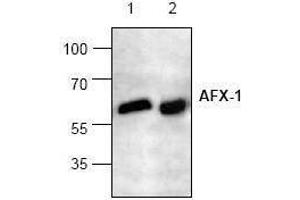 Image no. 1 for anti-Forkhead Box O4 (FOXO4) antibody (ABIN127087) (FOXO4 antibody)