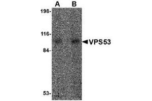 Western blot analysis of VPS53 in 293 cell lysate with VPS53 antibody at (A) 0. (VPS53 antibody  (Center))