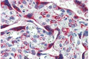 Placenta, Human: Formalin-Fixed, Paraffin-Embedded (FFPE) (IGFBP4 antibody  (AA 180-229))
