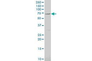 PHACTR2 polyclonal antibody (A01), Lot # 061025JCS1. (PHACTR2 antibody  (AA 56-143))