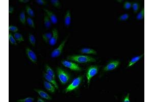 Immunofluorescent analysis of Hela cells using ABIN7142632 at dilution of 1:100 and Alexa Fluor 488-congugated AffiniPure Goat Anti-Rabbit IgG(H+L) (HTR3D antibody  (AA 107-210))