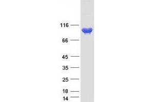Western Blotting (WB) image for Adenosine Monophosphate Deaminase 3 (AMPD3) (Transcript Variant 3) protein (Myc-DYKDDDDK Tag) (ABIN2714669)