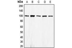 Western blot analysis of E Cadherin expression in HEK293T (A), A431 (B), MCF7 (C), mouse kidney (D), rat kidney (E) whole cell lysates. (E-cadherin antibody  (N-Term))