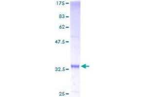 SS18L2 Protein (AA 1-77) (GST tag)