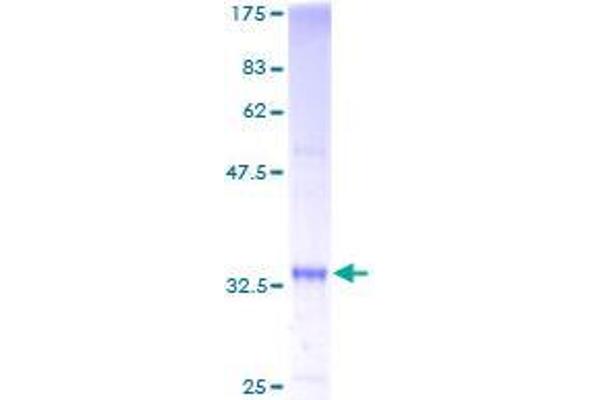 SS18L2 Protein (AA 1-77) (GST tag)