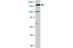 TOP2A monoclonal antibody (M01), clone 1E2 Western Blot analysis of TOP2A expression in Hela S3 NE . (Topoisomerase II alpha antibody  (AA 1435-1531))