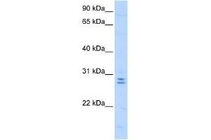 Western Blot showing MED4 antibody used at a concentration of 0. (MED4 antibody  (C-Term))